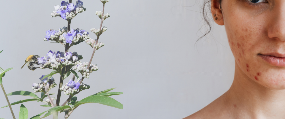 Mönchspfeffer und Periode